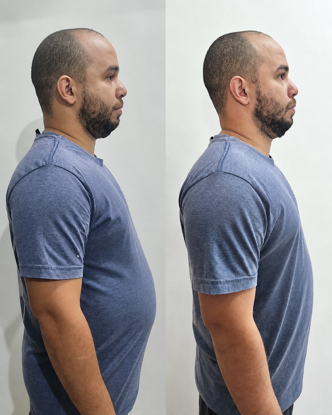 -4kg em 7 dias